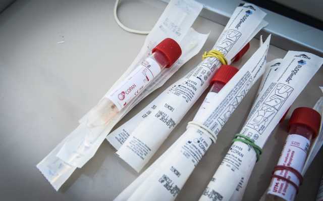 Tamponi Campioni Falsi Positivi