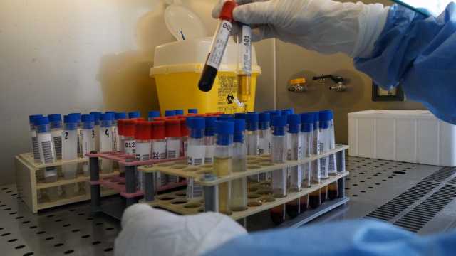 Coronavirus 26