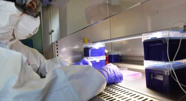 Lab Virus
