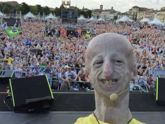 È morto Sammy Basso: era il malato di progeria più longevo al mondo