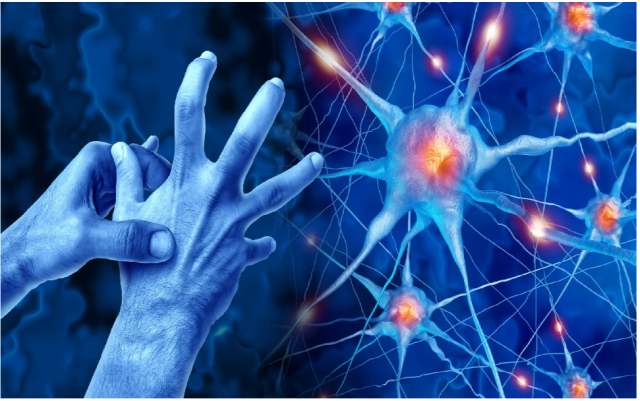 Prevedere l'avanzamento del Parkinson: lo studio italiano che segna la svolta