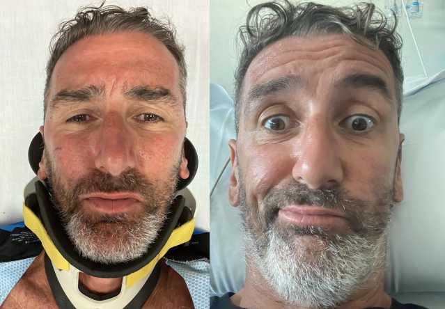 Paura per il consigliere Corrado Sorrentino, l'incidente in bici: 