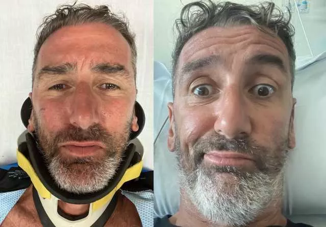 Paura per il consigliere Corrado Sorrentino, l'incidente in bici: 