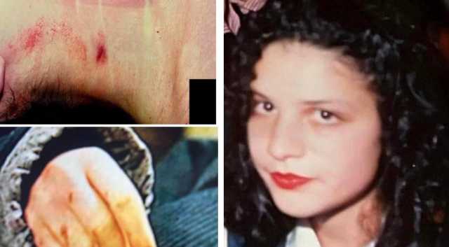 Manuela Murgia, la famiglia pubblica le foto dei segni sul cadavere: 