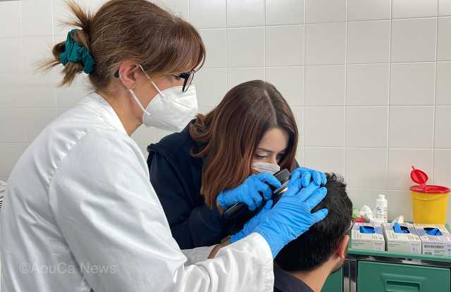Cagliari, Alopecia Areata Day: consulti gratuiti (senza prenotazione) al San Giovanni di Dio