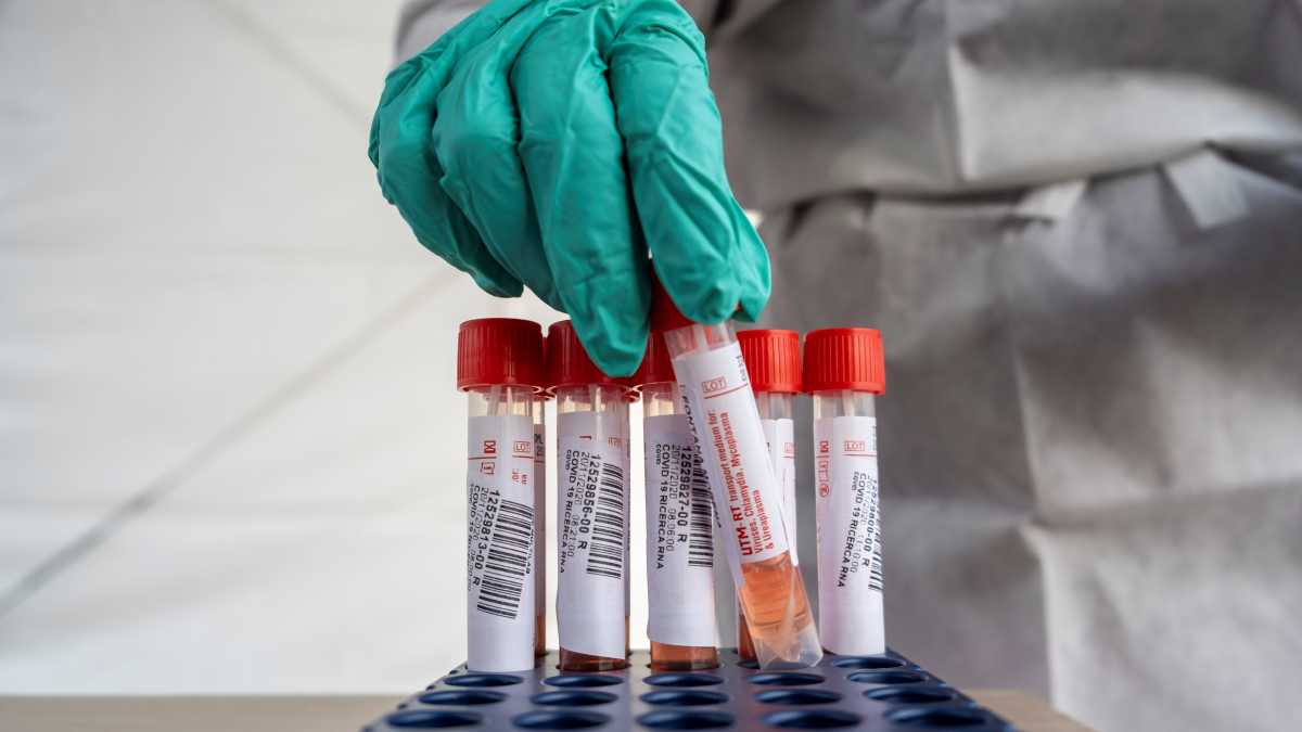 Ancora-test-contro-il-virus-in-Sardegna